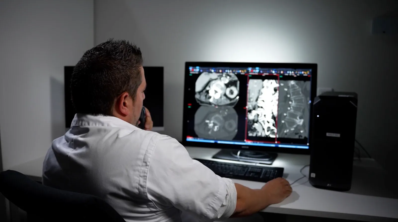 Dr. Allemeersch beoordeelt CT-beelden aan een radiologisch werkstation